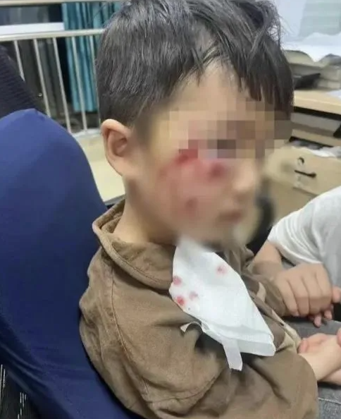 被瘋?cè)麤](méi)有“救命藥”，怎么辦？